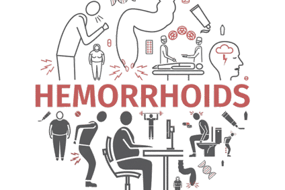 Patient receiving consultation for hemorrhoid treatment at Toronto Hemorrhoid Clinic, a Canada-certified Level 3 facility.